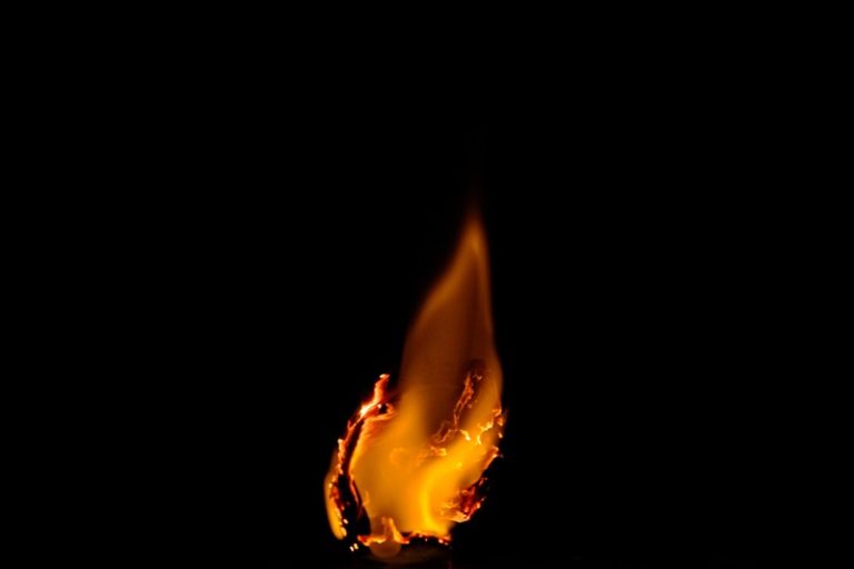 ドナちゃん役のトリ・スぺリングが、火鉢で第三度の火傷（＆私が第二度のやけどをした時のハナシ）